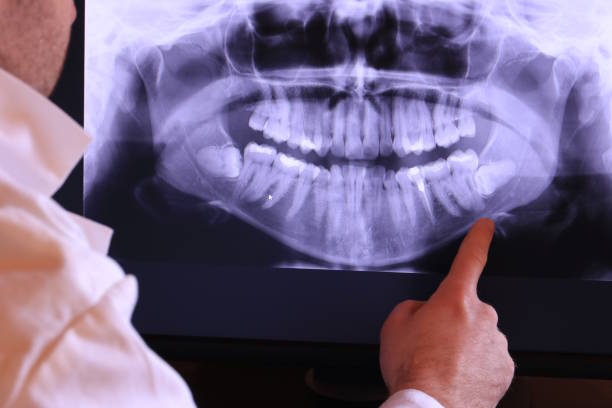 Best Emergency Care for Gum Disease in Hobart, WA